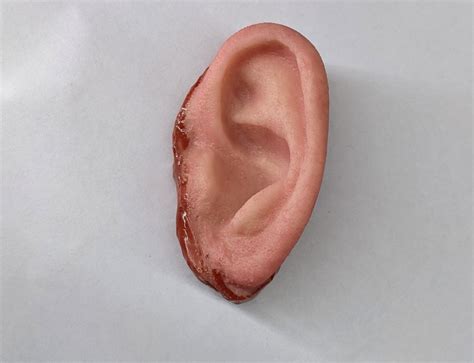 severed ear